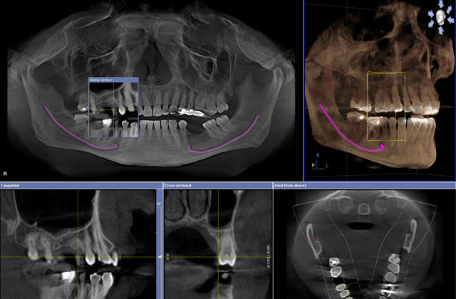 3D digital radiography report copy